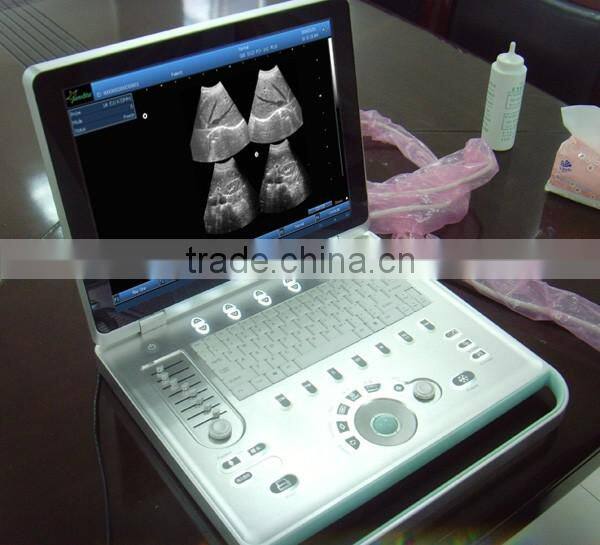 Sonostar hospital veterinary equipment B model ultrasound machine for sale V9