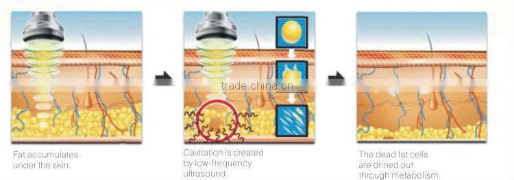 Hot!! Portable fat cavitation slimming machine S50(CE&ISO)lipo cavitation machine gel