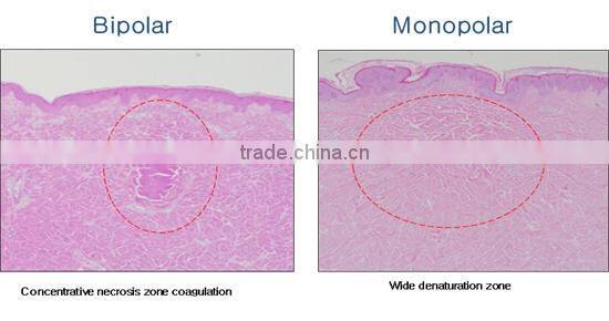 2014 Christmas Promotion!!! 2014 Newest fractional rf/fractional rf microneedle/rf fractional micro needle