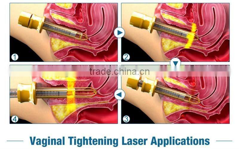 CO2 laser level for tightening the vagina cleaning machine fractional co2 laser