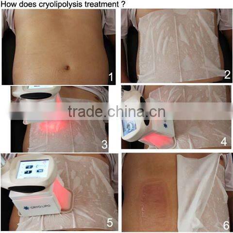 Technology 2016 fat loss cryolipolysis cold body sculpting cryo fat freeze slimming machine