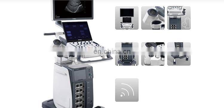 Latest Version Sonoscape P15 Trolley Color Ultrasound machine /cw color doppler ultrasound Sonoscape P15