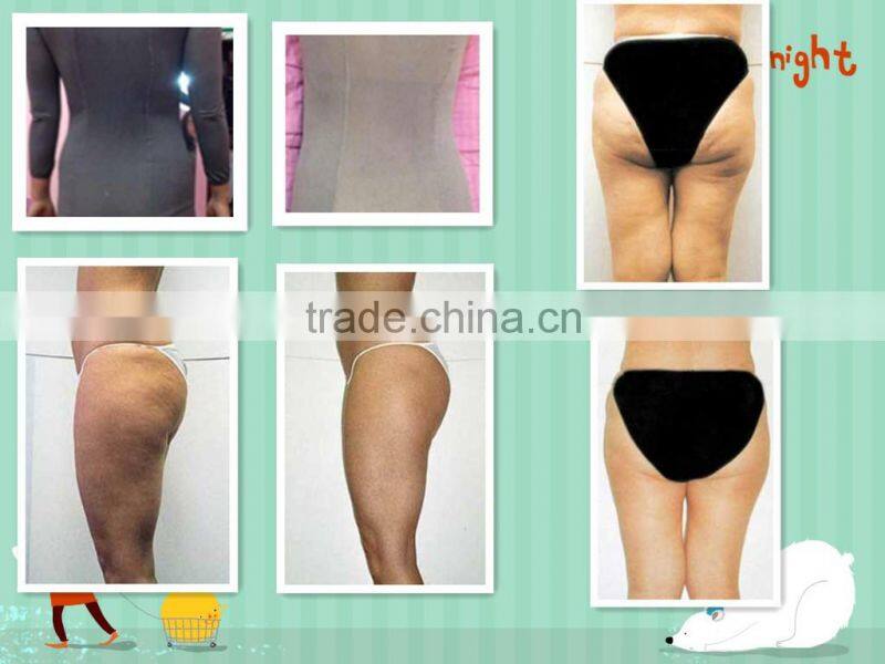 radio frequency beauty skin tightening RF device