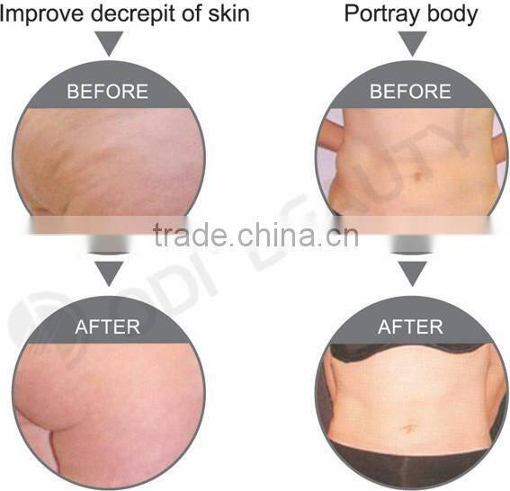 skin tightening beauty machine OD-R105 face lifting portable rf radio frequency facial machine for home use