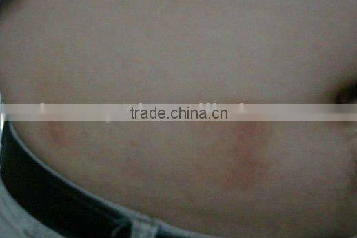 Hot Sale! criolipolisys beauty salon equipment