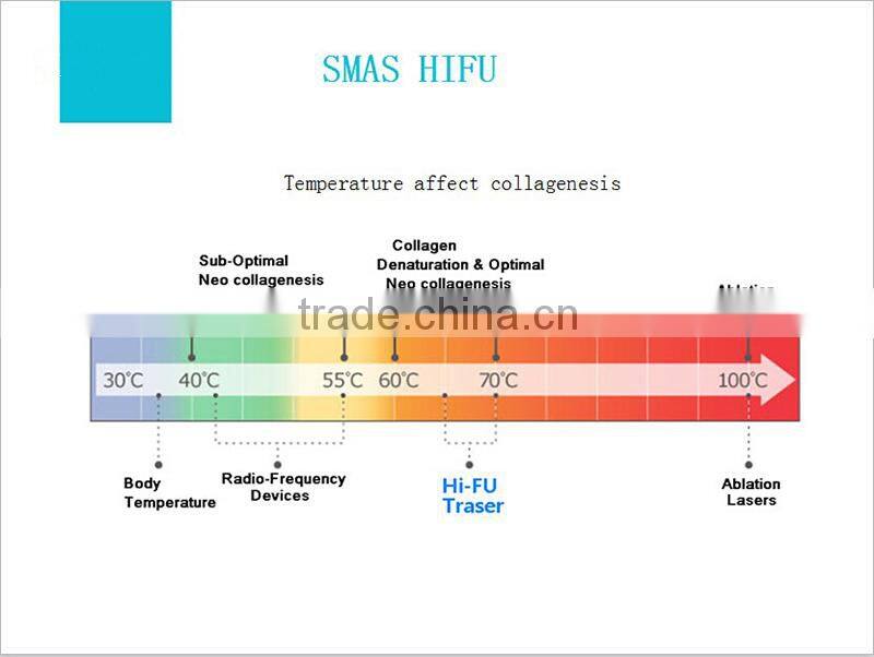 Face lifting SMAS for anti aging hifu wholesale