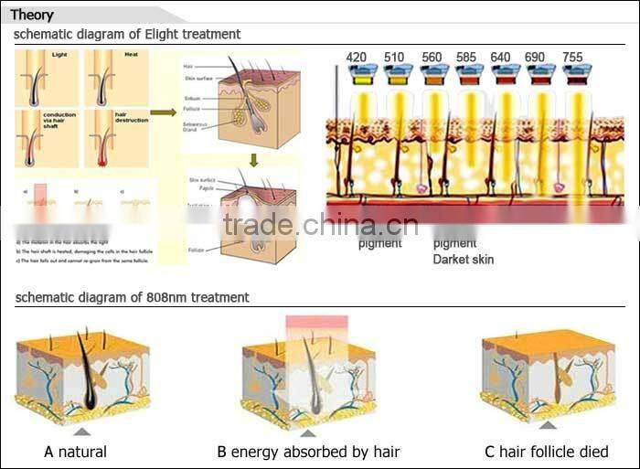 New type CE TUV multifunction elight lightsheer diode laser TEC cooling system