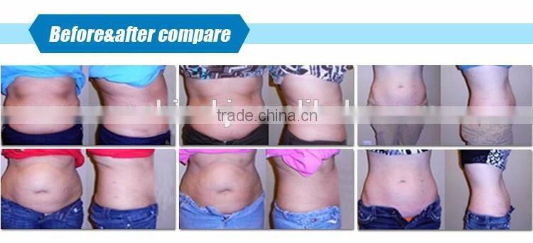Top quality 5 in 1 body beauty machine vacuum rf cavitation slimming with CE