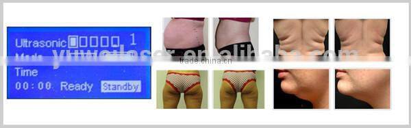 home used high quality inexpensive cavitation with 1 handpiece 2 years warraty