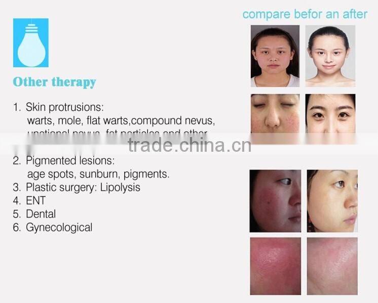 optical fiber device / 980nm diode laser spider vein removal vascular removal machine