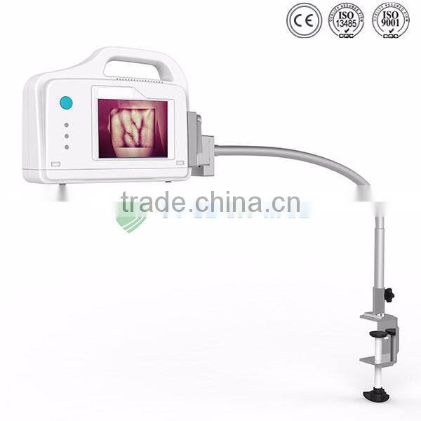 medical injection portable vein viewer price