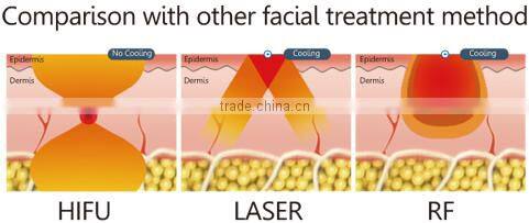 Professional HFU facial contouring best-sale High Intense Focus Ultrasound HFU10