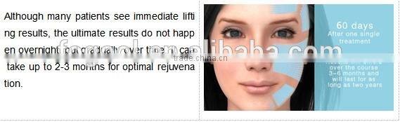 Portable Ultrasound Machine High Quality HIFU Face Lift