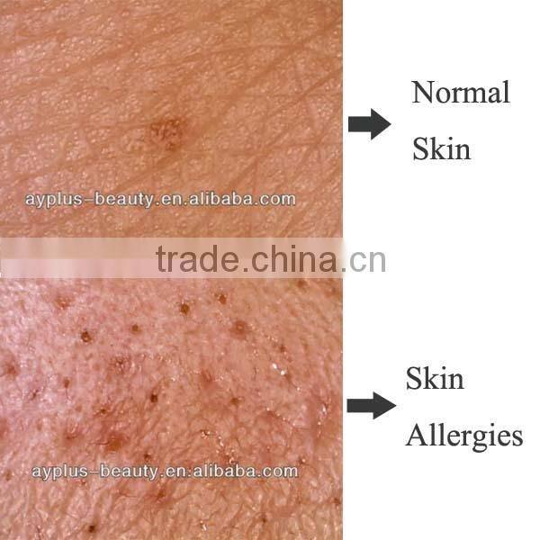 AYJ-J015(CE)Newest 5MP digital hair wood lamp skin analyzer/body skin hair analyser/3d skin analyzer/hair detector