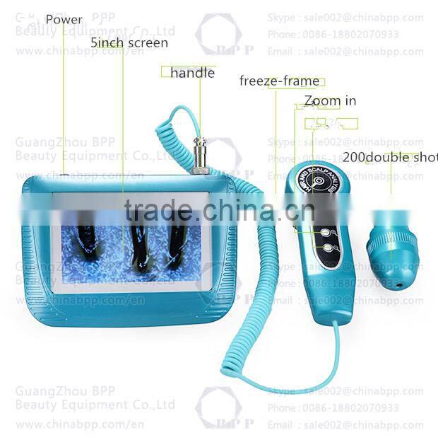 3D-Negative capture mode hair and scalp analysis system machine for sale