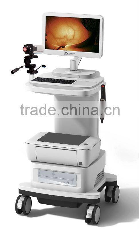 Professional Infrared Mammary Gland Inspection Equipment for mammary diseases