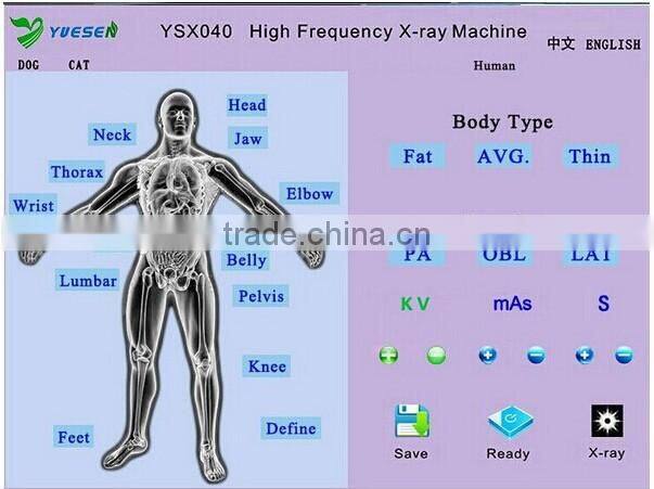 Hospital medical radiography equipment portable xray