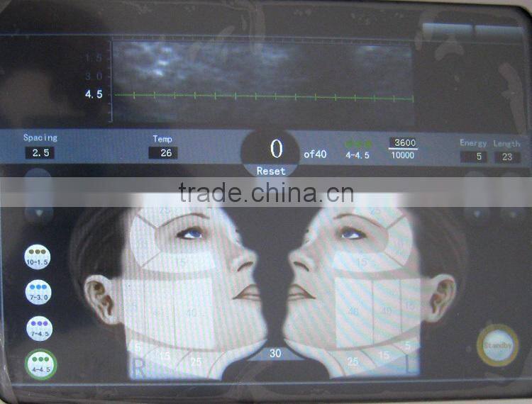2015 Best Beauty Equipment HIFU Anti-Wrinkle Machine With Lasting Effect EVERSUN HIFU-EX