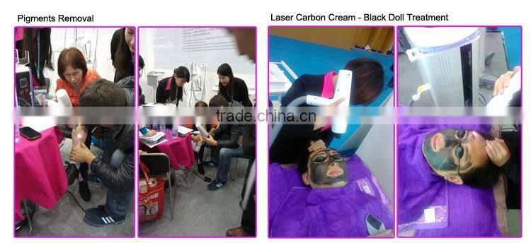 Best tattoos removal 532nm and 1064nm yag laser tip heads