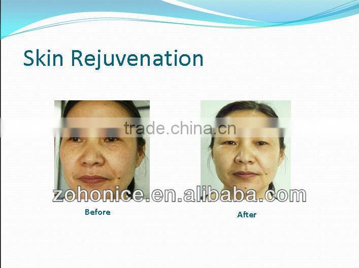 ER700B pigment remove device brown glow in the dark paint powder coating