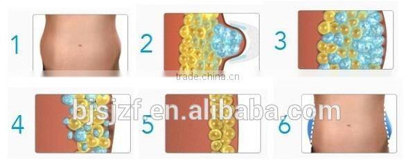 Vertical Anybeauty sl-4 fat removal machine with low price