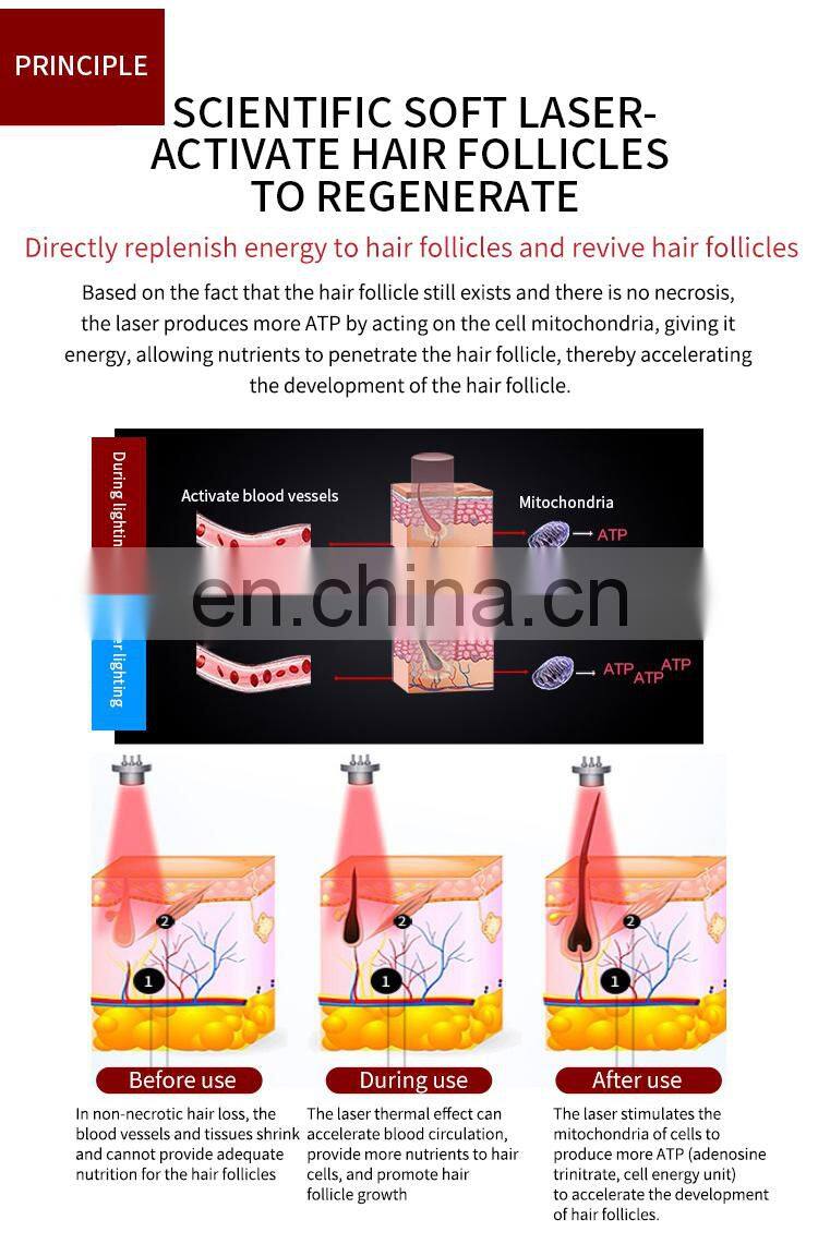 Salon Professional Anti Hair Loss Laser Diodes Machine Hair Follicle Detection Analysis Scalp Massager Hair Growth Machine