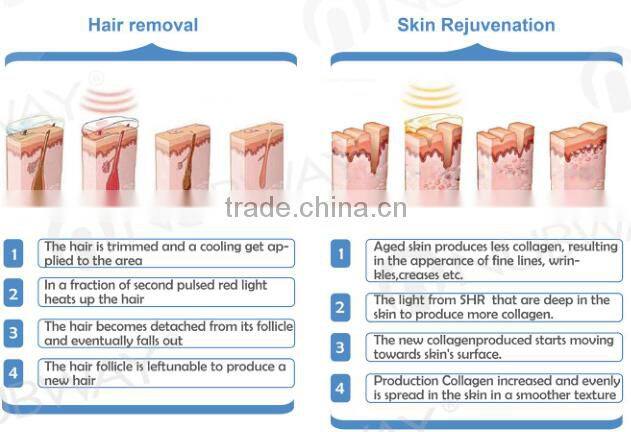 hair removal / Portable ipl laser hair removal machine / ipl home
