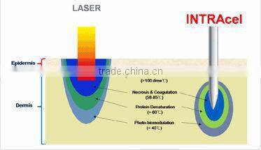 Personal care and beauty series product fractional rf skin lifting machine