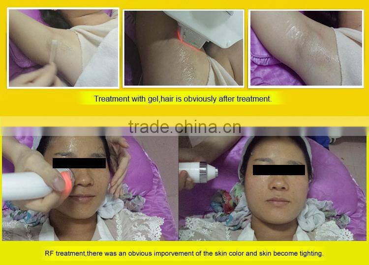 IPL + Elight + RF + ND YAG Laser Beauty Salon Equipment 3 in 1 Multi-Function Lasers