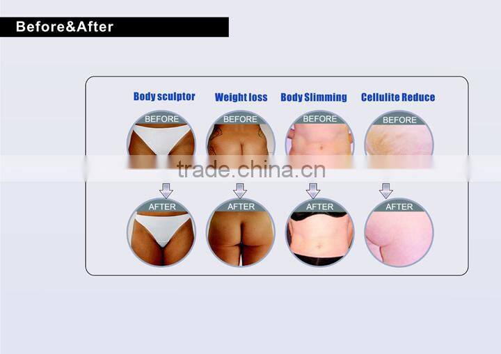 Cavitation Laser With Three Models Vacuum RF Handles Laser Function Machine