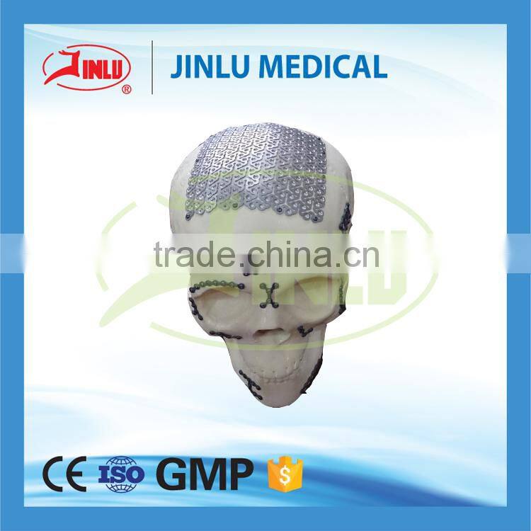 Maxillofacial plate, face mini plate, titanium plate
