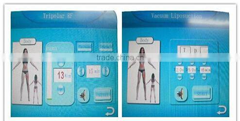 Effective fat reducer!!!! best vacuum rf portable cavitation slimming machine