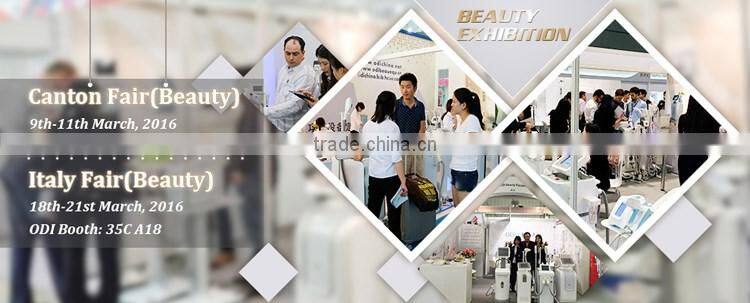 Medical CE! Quick freckle remover feature EO Active YAG Q-switch laser