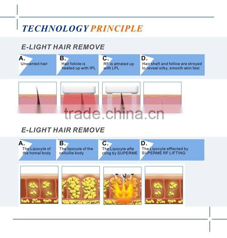 IPL Elight Laser Machine for Hair Removal Beauty Salon Machine