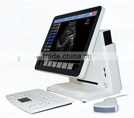UProbe-20 Probe Type Ultrasound Scanner for laptop