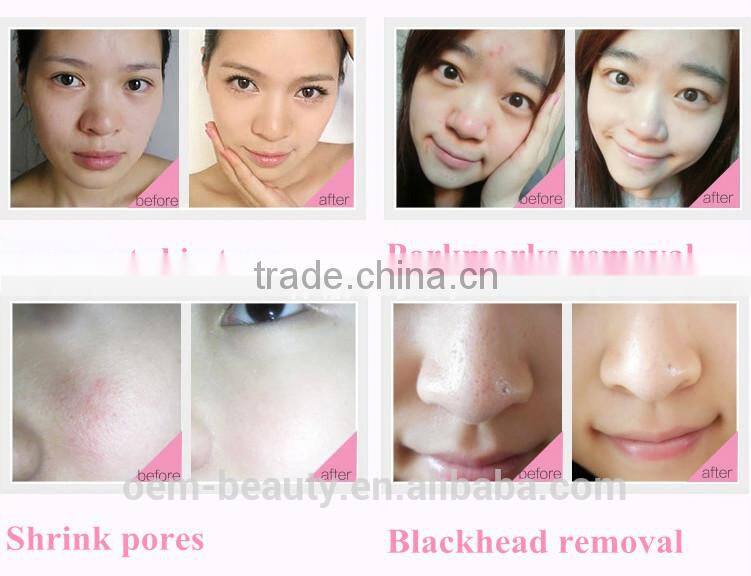 electric rotating sonic facial cleansing brush face clean brush exfoliate cleaning brush