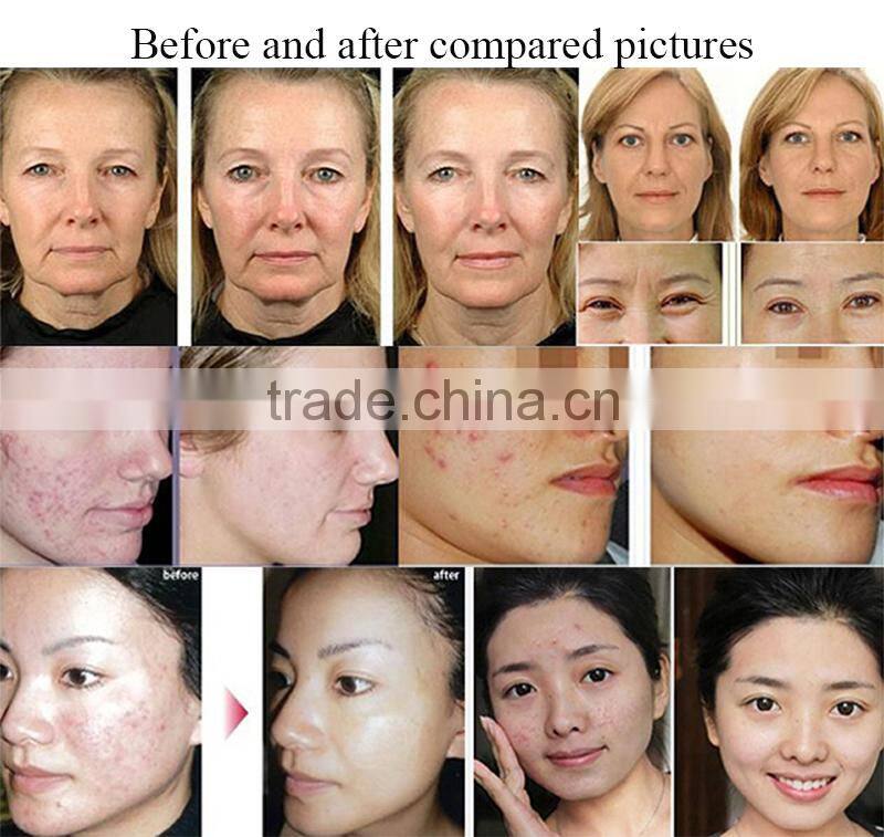 China top rated portable diamond dermabrasion crystals skin tightening & facial cleansing machine