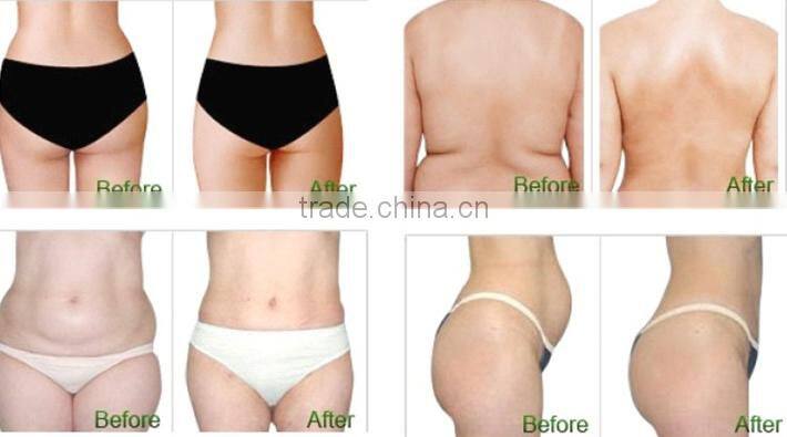 portable cavitation machine, liposlim cavitation machine, trilipo cavitation machine