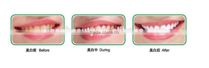 RFIC card 12pc blue light dental led curing light home use Led Teeth Whitening Light
