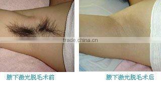 . Economic Portable IPL Hair removal Beauty Machine