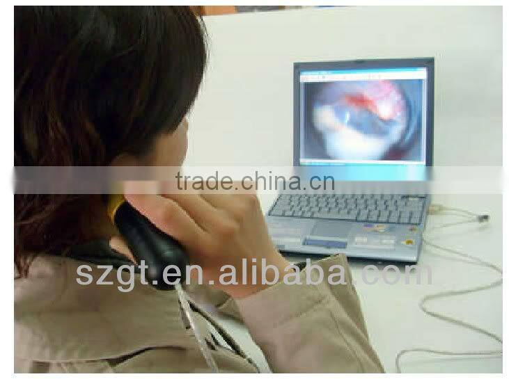 doctor mini USB Otoscope Camera