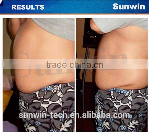 (SW-255F)2014 hot sale! focus ultrasonic keyword cavitation slimming device