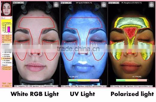 Skin Analyzer Portable Facial Skin Analyzer Scanner Diagnosis Machine