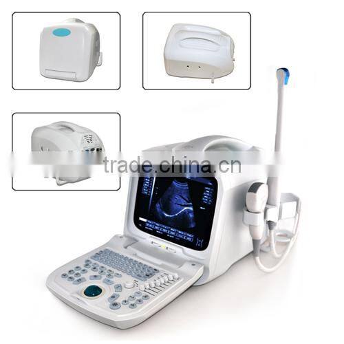 2015 new Full Digital Portable Ultrasound Scanner (PC)