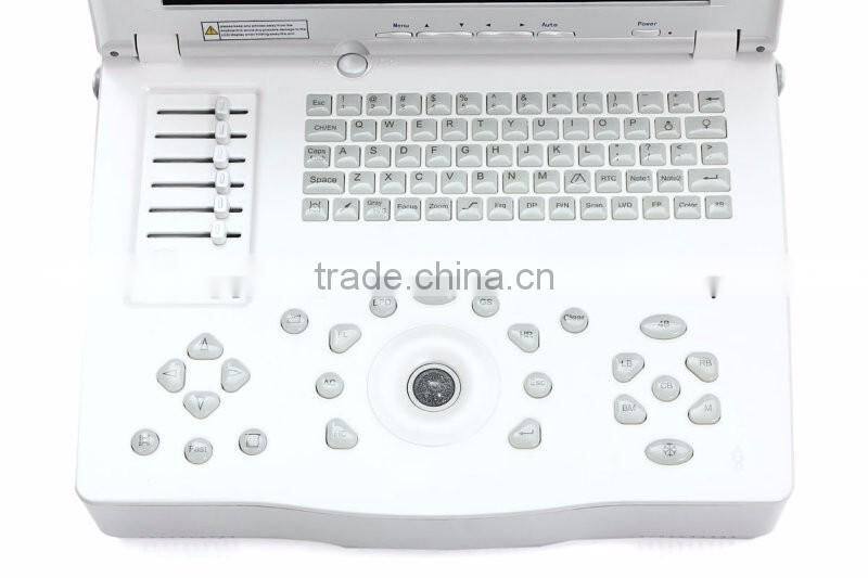 Hospital clinical equipment 15-inch full digital Laptop Ultrasound Scanner China made portable ultrasound machine
