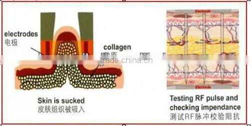 hm-rf-a100 monopolar