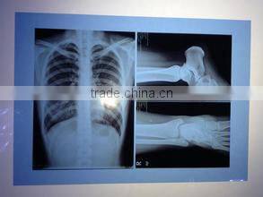 medical film thermal meter printer Medical laser paper film