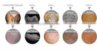 E6 1064nm 532nm lengthwave IPL/ nd yag laser hair removal & tattoo removal