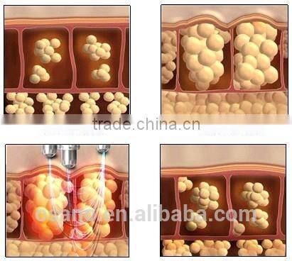 Hot sale 4 in 1 5MHZ Multipolar RF+Tripolar RF+Bipolar RF+Cavitation for home use LM-VR200