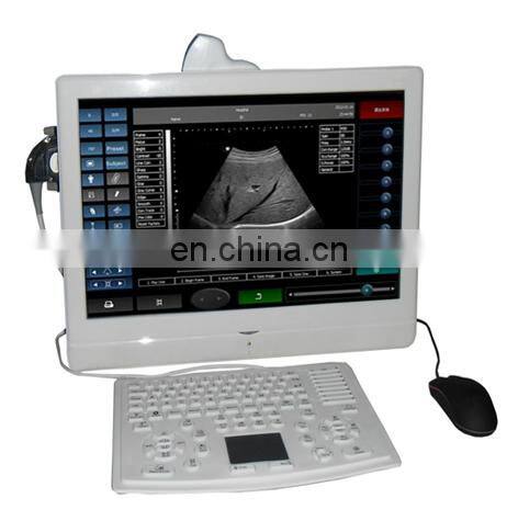 HC-A005 Pregnancy Ultrasound Scan/Medical Diagnostic Equipment/18 inch large LCD